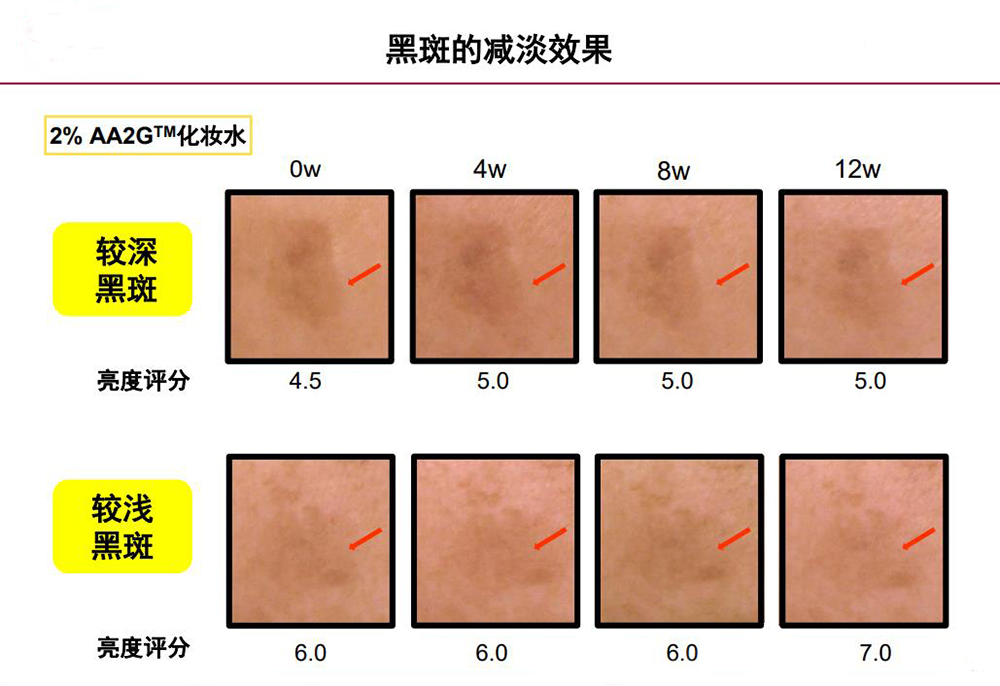 第一种材料：AA2G.jpg